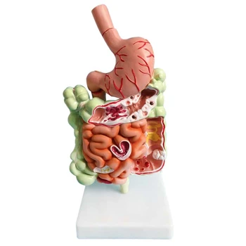 Az Emberi Emésztőrendszer Modell Gyomor Anatómia Vakbél, Vastagbél Végbél Duodenum Emberi Belső Szervek Struktúra Modell